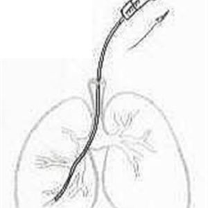 VAP Diagnostic Catheters